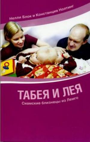 Табея и Лея. Сиамские близнецы из Лемго